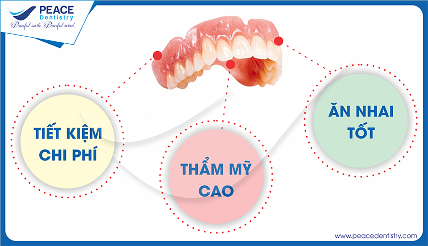 Uu-diem-cua-pp-ham-thao-lap