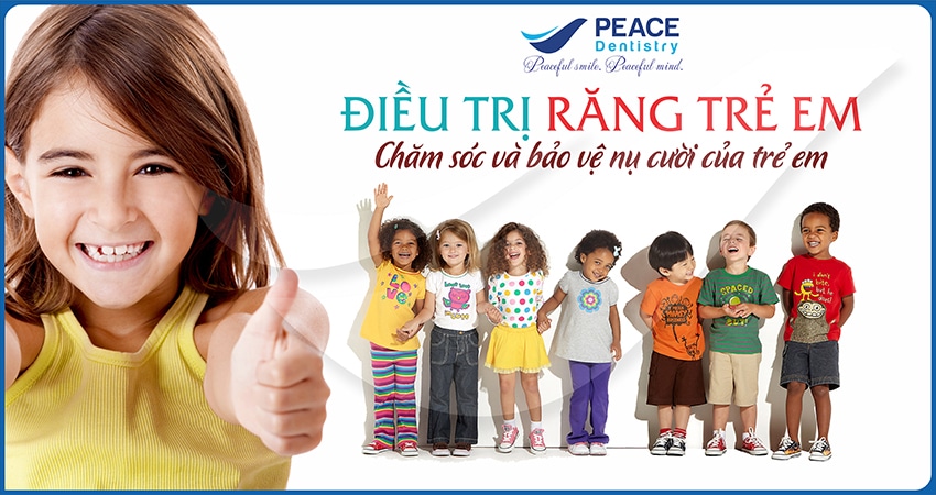 Điều trị răng trẻ em