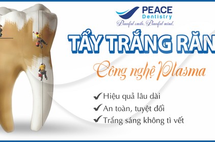 Tẩy trắng răng công nghệ plasma