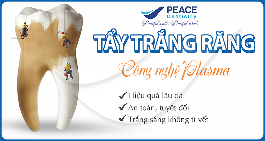 banner-tay-trang