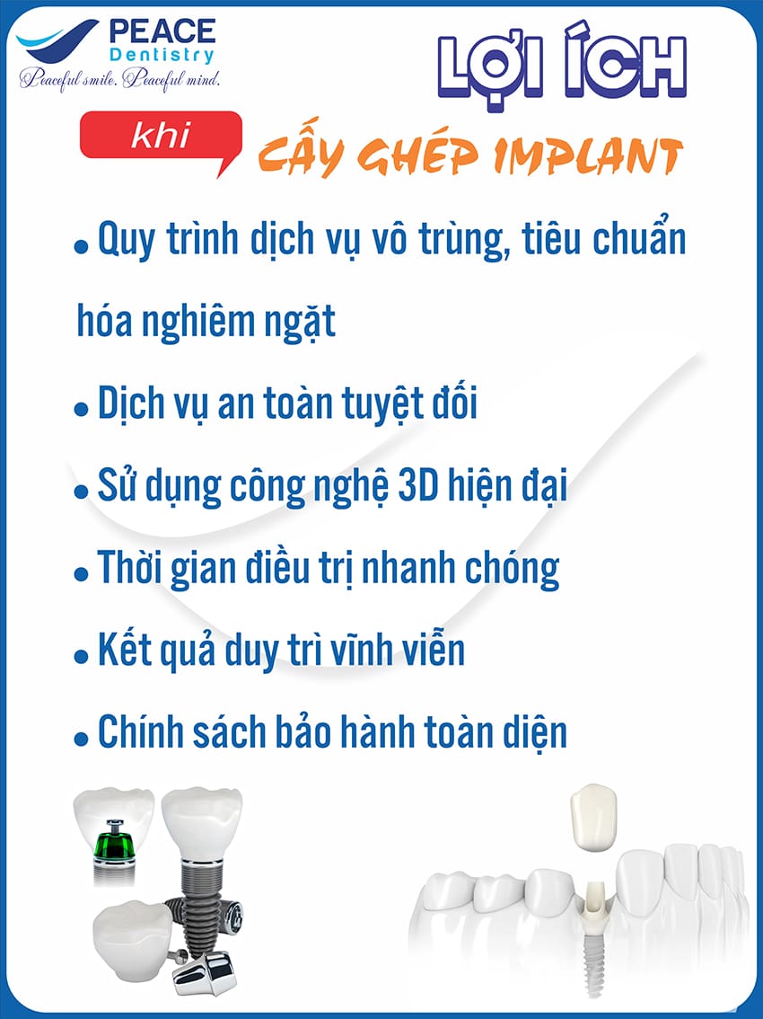 lợi ích khi cấy ghép implant