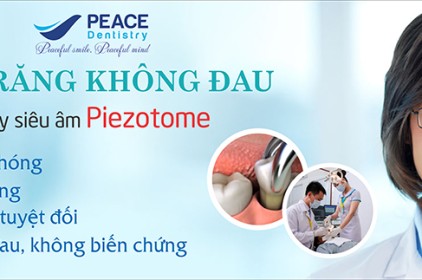 Lý do nhất định phải nhổ răng khôn mọc lệch 90 độ