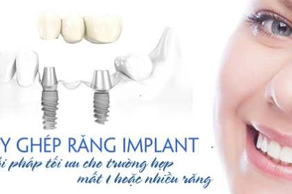 Mất răng toàn hàm có thể cấy ghép implant được không