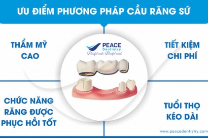 Cầu răng sứ cho răng xấu xỉn màu