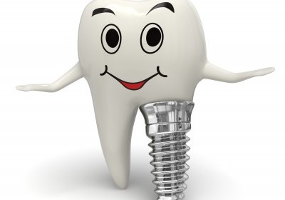 Quy trình cấy ghép implant an toàn với sức khỏe