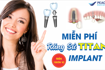 Trồng răng implant – Tặng sứ Titan